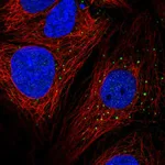 Atlas Antibodies Anti-AP1M2 Antibody