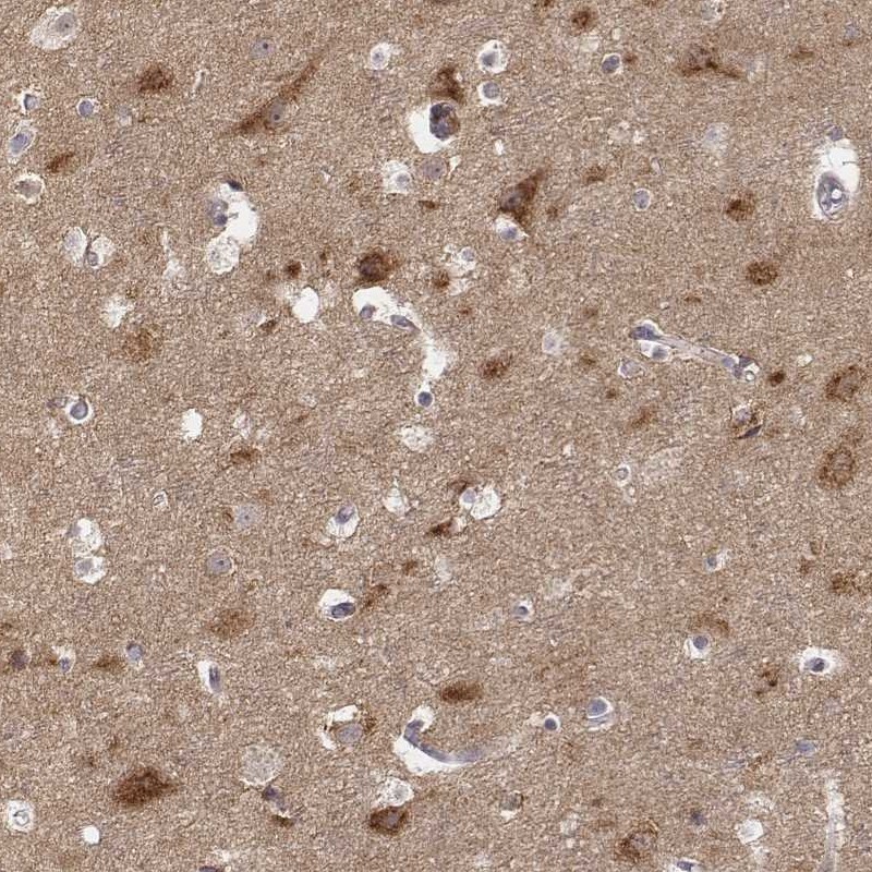 Atlas Antibodies Anti-AP1B1 Antibody