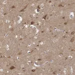 Atlas Antibodies Anti-AP1B1 Antibody