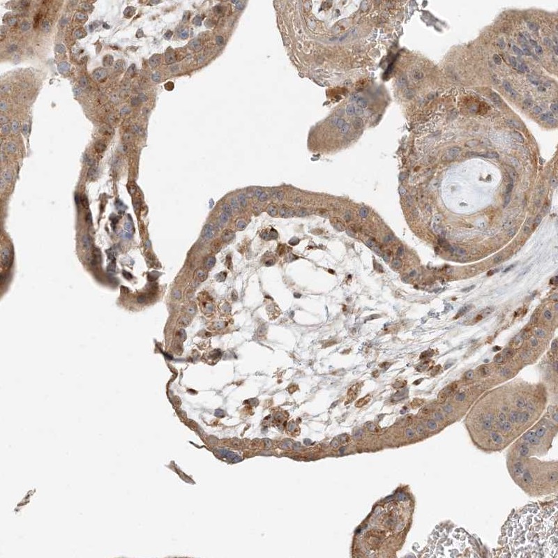 Atlas Antibodies Anti-AP1AR Antibody