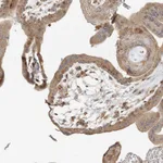 Atlas Antibodies Anti-AP1AR Antibody