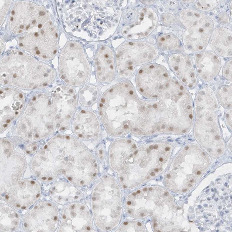 Atlas Antibodies Anti-AP000322.53 Antibody