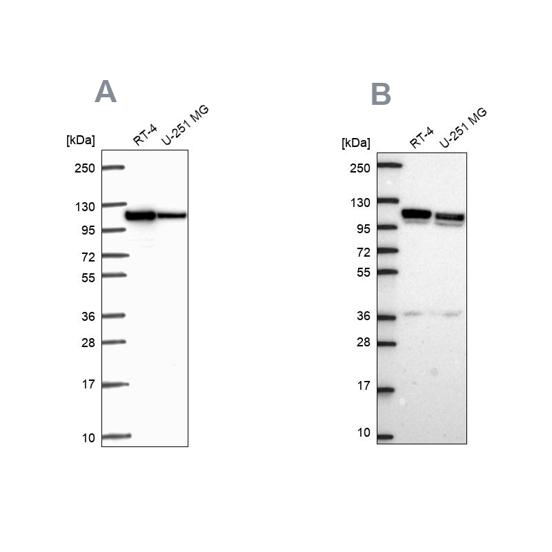 Atlas Antibodies Anti-AP1B1 Antibody