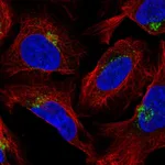 Atlas Antibodies Anti-AP1AR Antibody