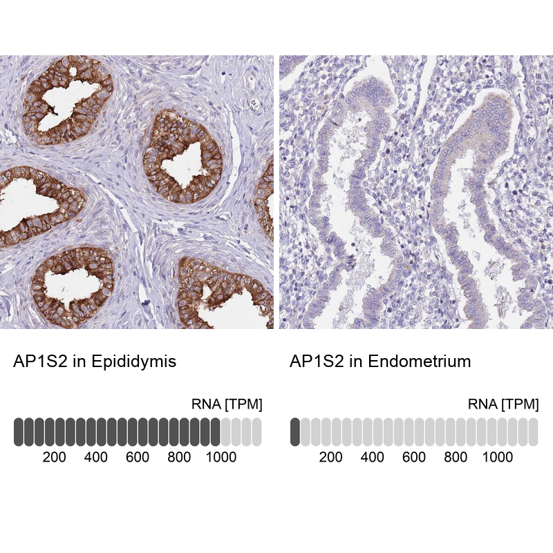 Atlas Antibodies Anti-AP1S2 Antibody