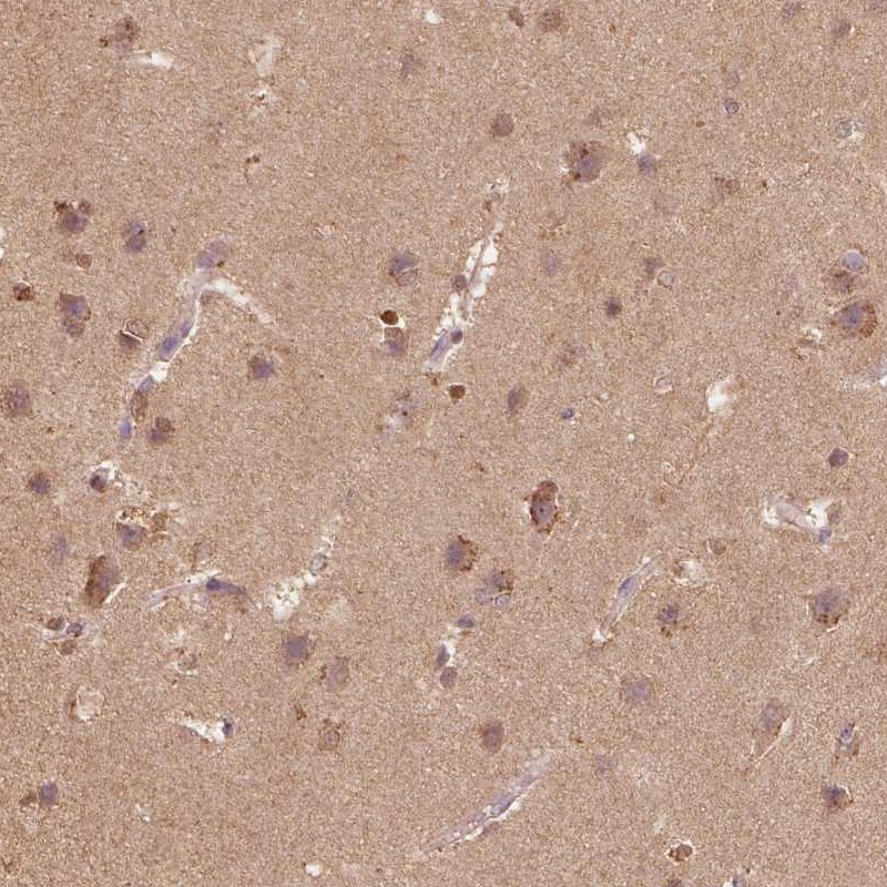 Atlas Antibodies Anti-AP2B1 Antibody