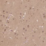 Atlas Antibodies Anti-AP2B1 Antibody