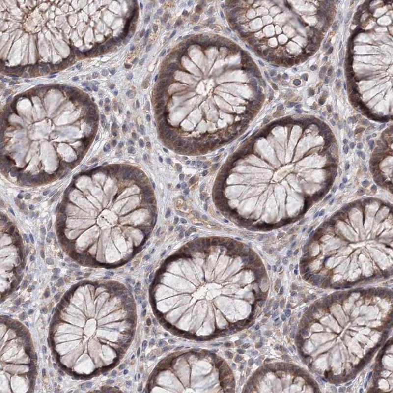Atlas Antibodies Anti-AP3B1 Antibody