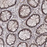 Atlas Antibodies Anti-AP3B1 Antibody