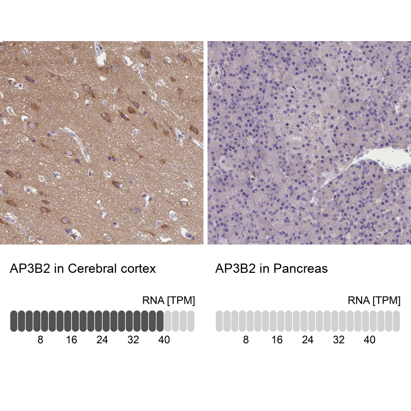 Atlas Antibodies Anti-AP3B2 Antibody