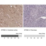 Atlas Antibodies Anti-AP3B2 Antibody