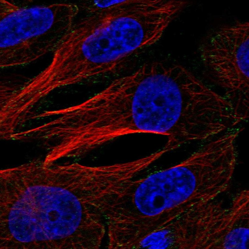 Atlas Antibodies Anti-AP2M1 Antibody