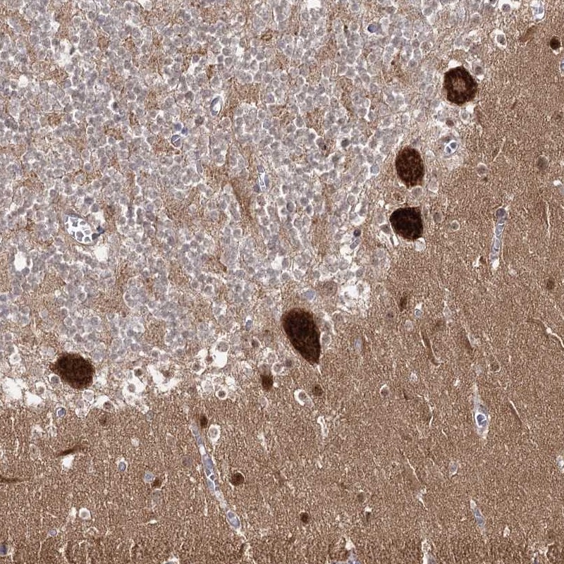 Atlas Antibodies Anti-AP2M1 Antibody