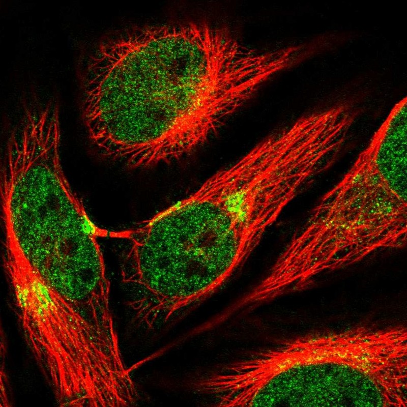 Atlas Antibodies Anti-AP3B1 Antibody