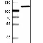Atlas Antibodies Anti-AP2B1 Antibody