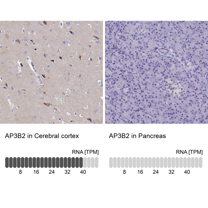 Atlas Antibodies Anti-AP3B2 Antibody
