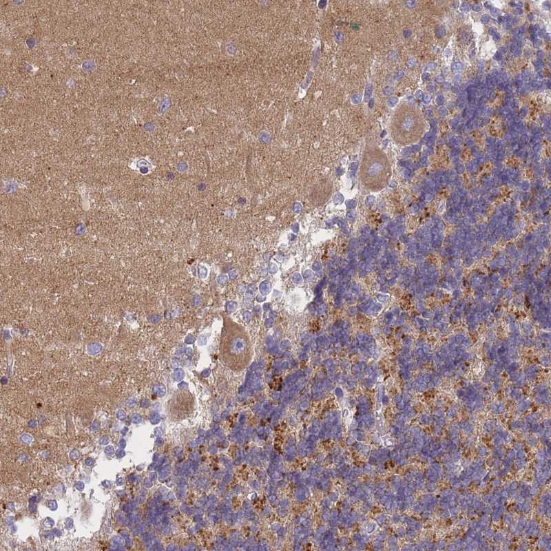 Atlas Antibodies Anti-AP3M1 Antibody