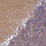 Atlas Antibodies Anti-AP3M1 Antibody
