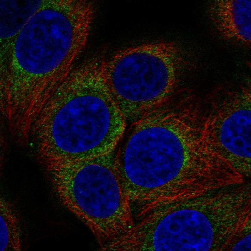 Atlas Antibodies Anti-AP3D1 Antibody