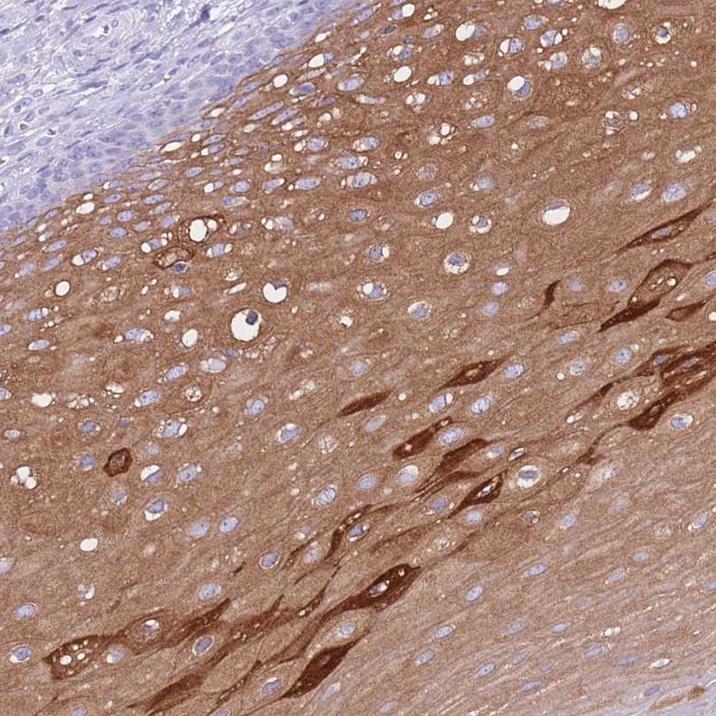 Atlas Antibodies Anti-AP3S2 Antibody