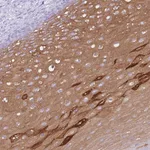 Atlas Antibodies Anti-AP3S2 Antibody