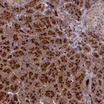 Atlas Antibodies Anti-AP4E1 Antibody