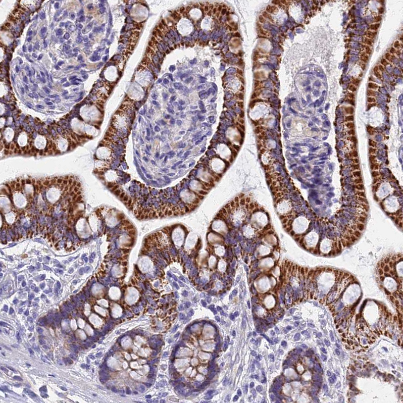 Atlas Antibodies Anti-AP4E1 Antibody
