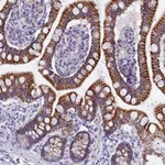 Atlas Antibodies Anti-AP4E1 Antibody