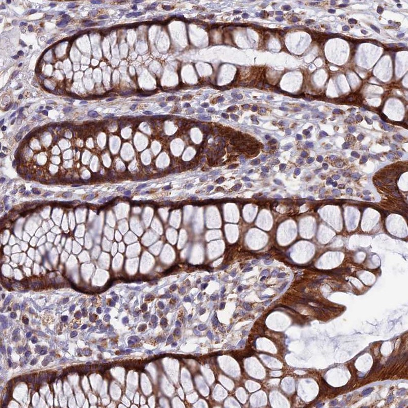 Atlas Antibodies Anti-AP4S1 Antibody