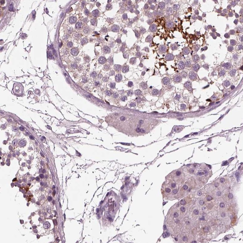 Atlas Antibodies Anti-AP4M1 Antibody