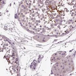Atlas Antibodies Anti-AP4M1 Antibody