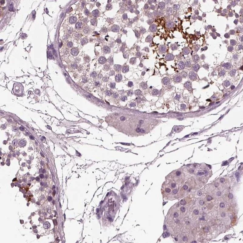 Atlas Antibodies Anti-AP4M1 Antibody