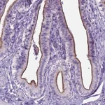 Atlas Antibodies Anti-AP5B1 Antibody