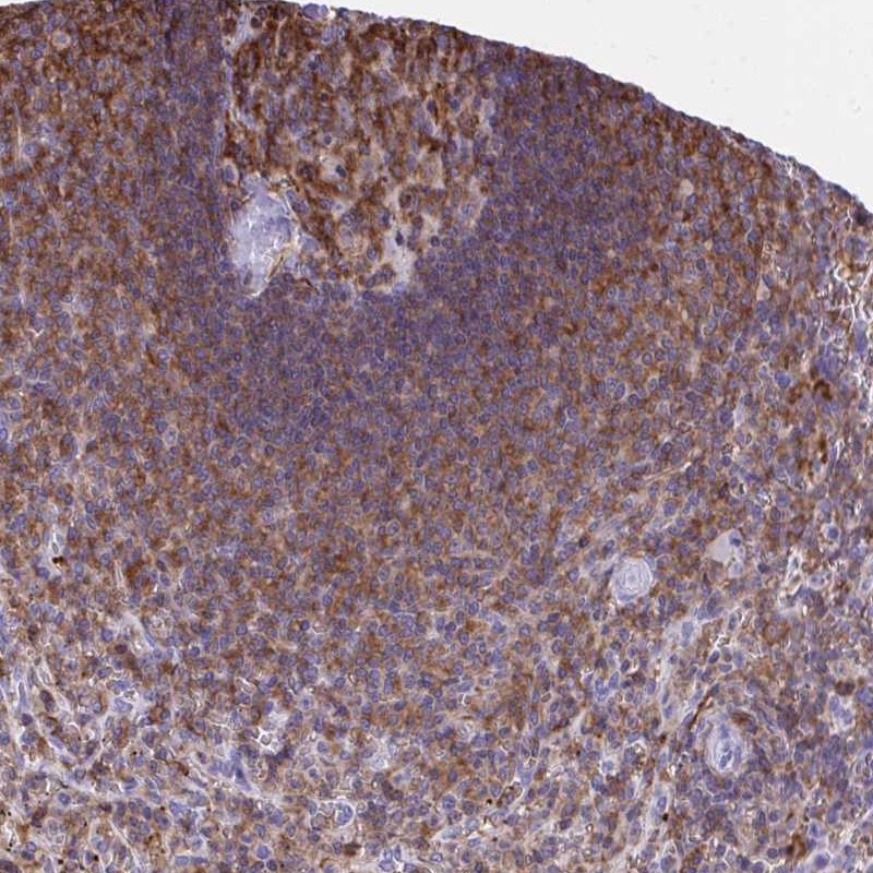 Atlas Antibodies Anti-AP5M1 Antibody