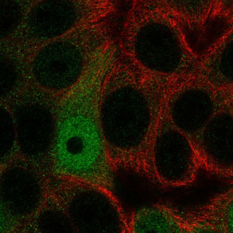 Atlas Antibodies Anti-AP5S1 Antibody
