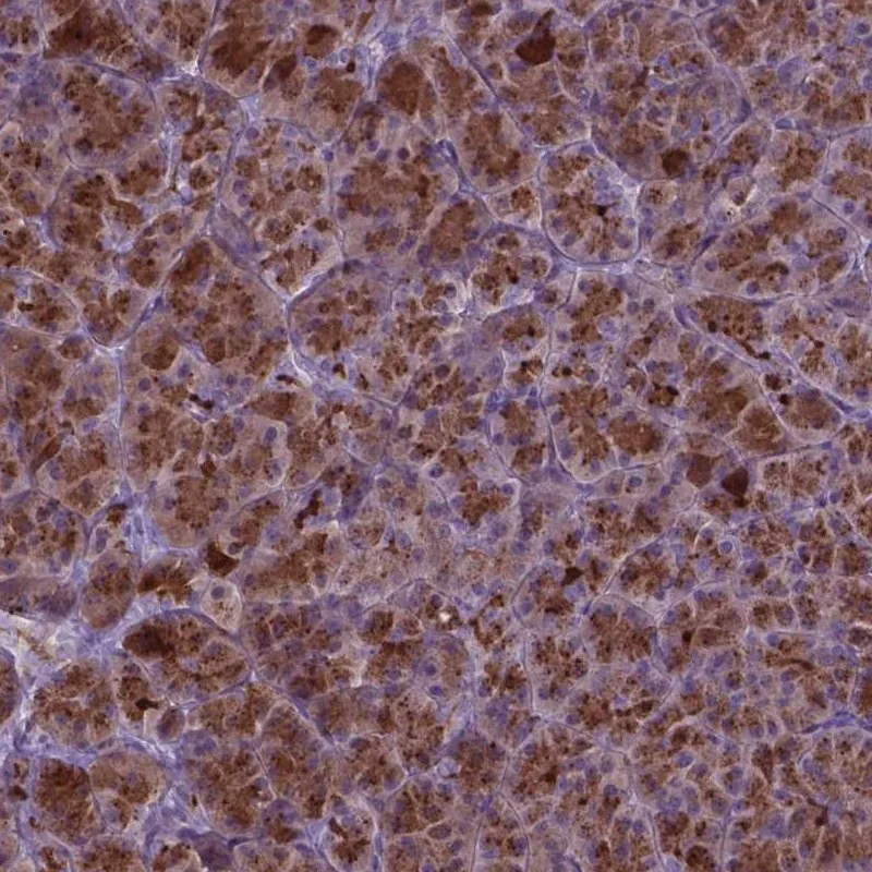 Atlas Antibodies Anti-AP5B1 Antibody
