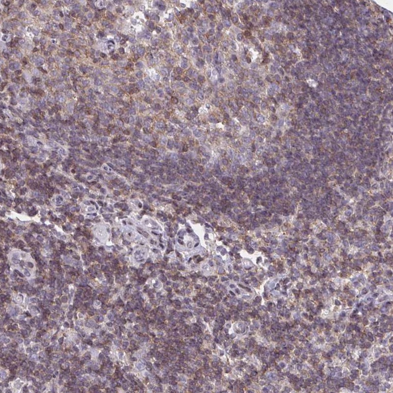 Atlas Antibodies Anti-AP5M1 Antibody