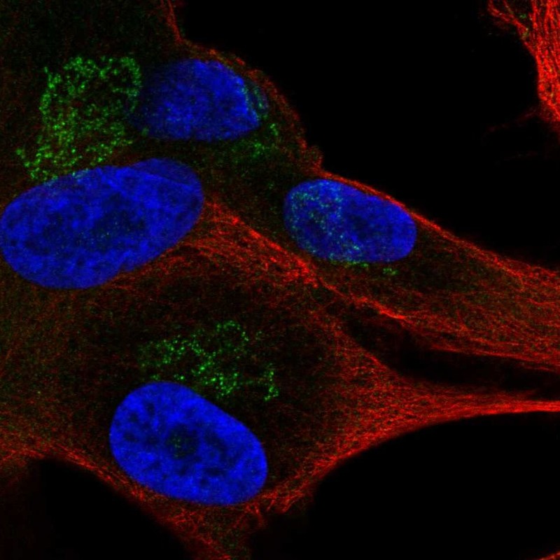 Atlas Antibodies Anti-APBA1 Antibody