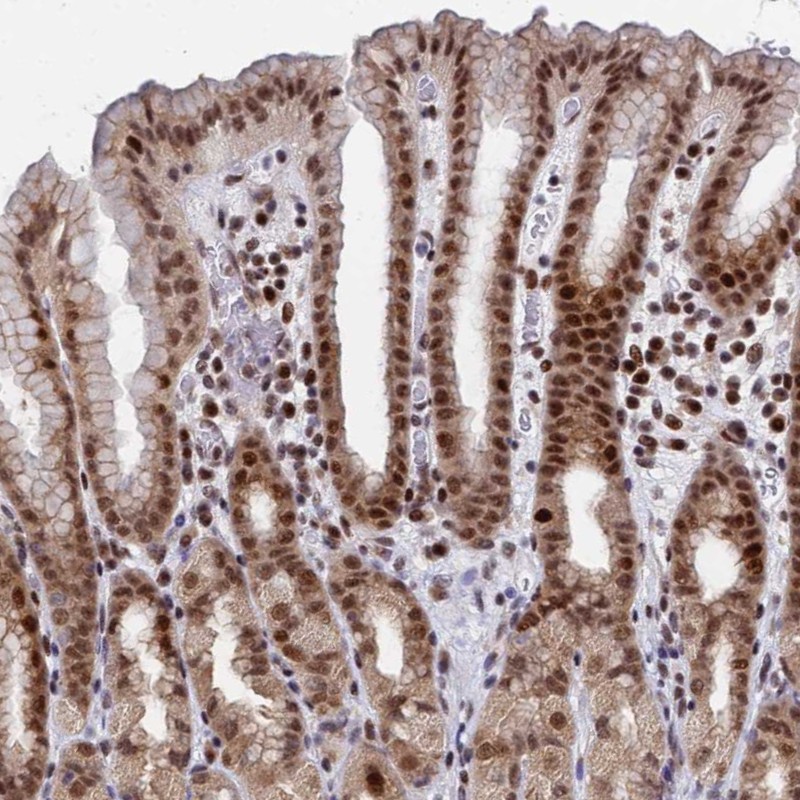 Atlas Antibodies Anti-AP5Z1 Antibody