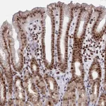 Atlas Antibodies Anti-AP5Z1 Antibody