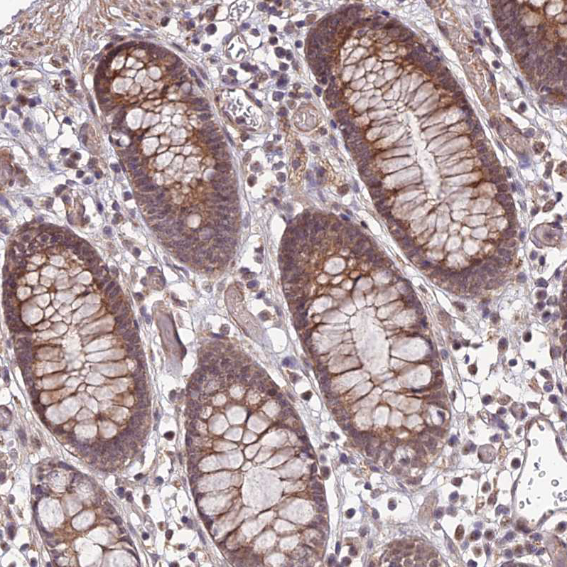 Atlas Antibodies Anti-APBA3 Antibody