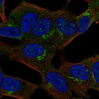 Atlas Antibodies Anti-APBA2 Antibody