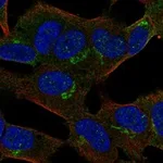 Atlas Antibodies Anti-APBA2 Antibody