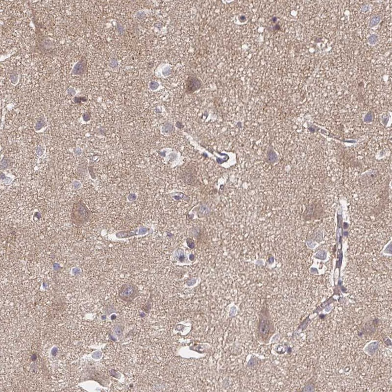 Atlas Antibodies Anti-APBB1 Antibody
