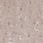 Atlas Antibodies Anti-APBB1 Antibody