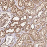 Atlas Antibodies Anti-APBB1 Antibody