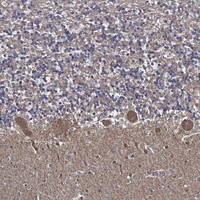Atlas Antibodies Anti-APBB3 Antibody