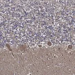 Atlas Antibodies Anti-APBB3 Antibody