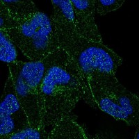 Atlas Antibodies Anti-APC Antibody