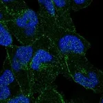 Atlas Antibodies Anti-APC Antibody